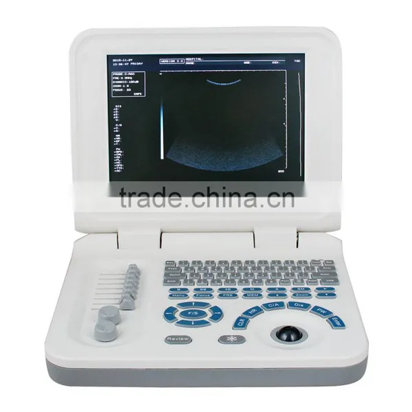 RUS-9000F2 CE&ISO Easy Carrying Portable Ultrasound Scanner Price photo-2