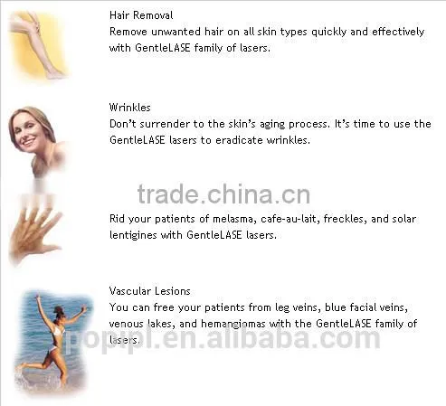 755nm Laser ND Yag Long Pulse Naevus Of Ito Removal Laser 2in1 Machine China Factory Popipl 1-10Hz photo-4