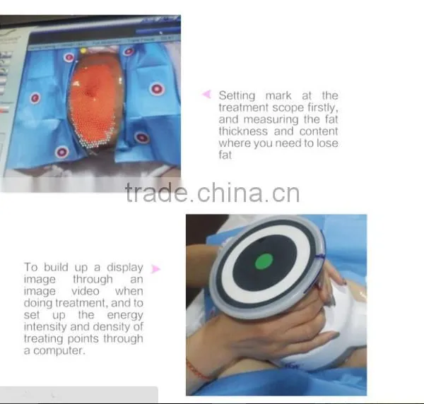 Ultrashape New Slimming Technology Machine Cavitation Slimming Machine photo-2