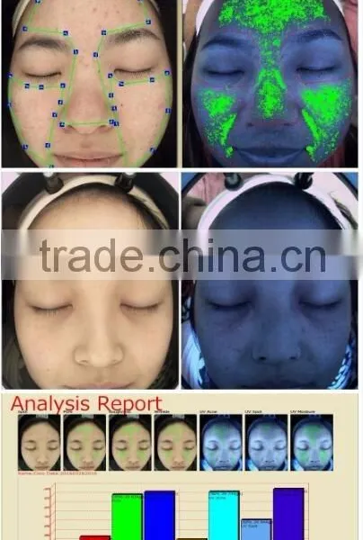 Cheaper Wholesale Skin Analyzer Facial Care Basic Test Tool for Beauty Salon Spa photo-6