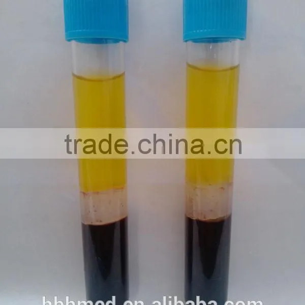 Non-pyrogen 10ml ACD Anticoagulation Prp Kit Quality Choice photo-2