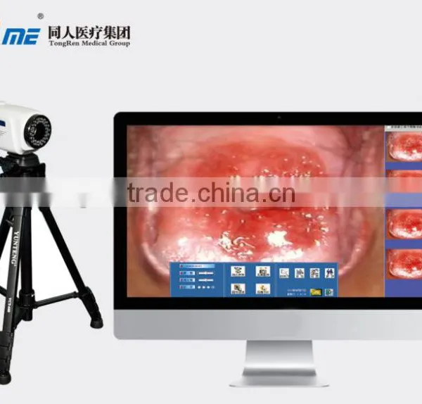 Digital Video Colposcope, Laptop Video Colposcope, Gynecology Video Colposcope