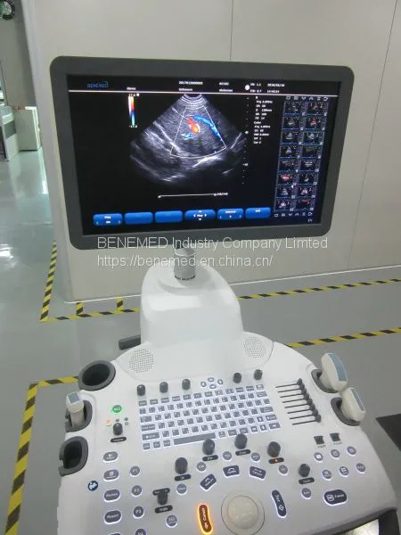 Trolly 2D Echocardiography Color Doppler Ultrasound Scanner Diagnosis Equipment photo-3