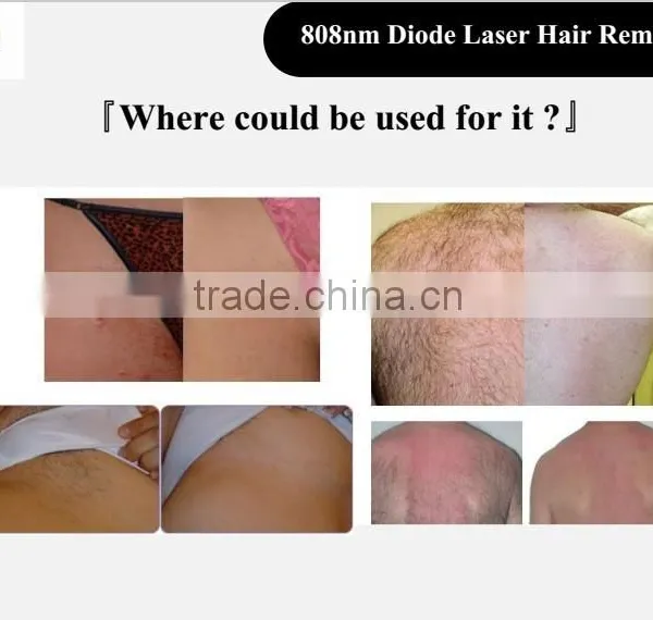 Skin Rejuvenation Diode Laser 808nm Portable Diode Laser IPL Hair Removal Machine From POPIPL China Factory Poplaser 8.4 Inches photo-4