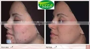 GUARANTEED NATURAL & PURE NEEM OIL photo-3