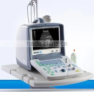 FM-2000 Portable Ultrasound Machine for Sale photo-4