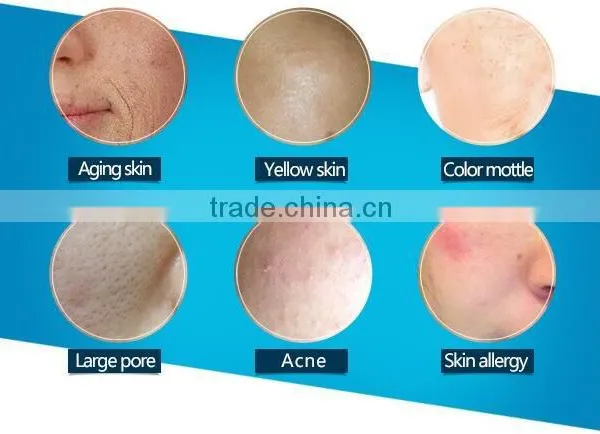 Medical Laser Rf Fractional Co2 Laser Spot Scar 10.6um Pigment Removal Machine/supercritical Co2 Extraction Machine Skin Renewing 8.0 Inch photo-6