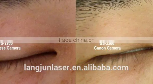 Skin Analyzer Magnifier Machine / BS-3200 Skin Analyzer photo-2