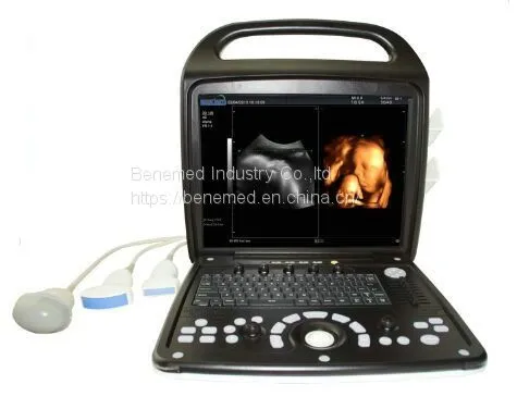 Portable 4D Color Doppler Ultrasound Scanner BENE-3V photo-2