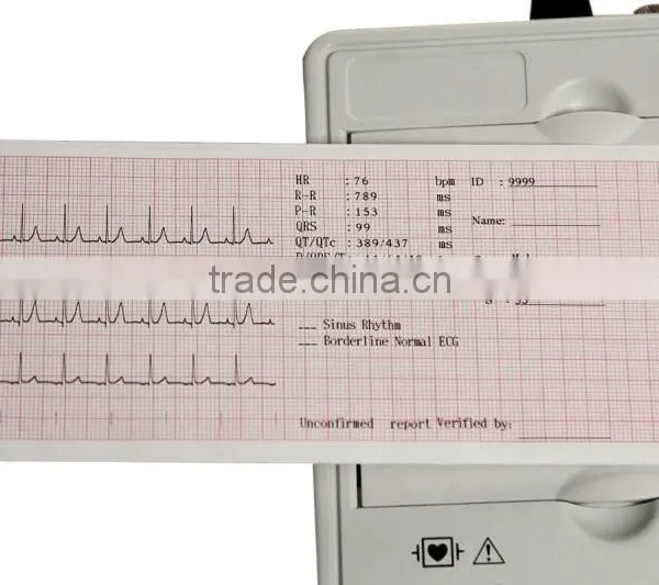 2016 Handheld Promotion Model 7-inch Color LCD 3-channel 12-lead Electrocardiograph ECG Machine EKG Machine-EKG-903A3-Shelly photo-5