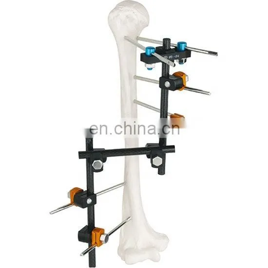 Competitive Price Orhtopedic External Fixator for Femur Surgery photo-2