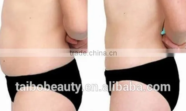 Cryolipolysis Weight Loss Machines From 500W Beauty Salon Equipment Supplier Body Shaping photo-5