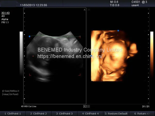 Trolly Based Color Doppler System Ultrasound Diagnostic Scanner photo-3