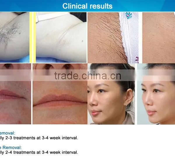 Shrink Trichopore Ipl Shr Hair Removal Machine Vertical Spa Vertical photo-6