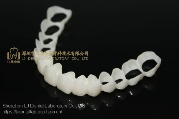 CAD/CAM PMMA Resin Clip on Veneers, Snap-on-veneers, Smile Veneers, Laboratoire Dentaire, Dentallabor, Laboratorio Dental, Dental Laboratory, Shenzhen LJ Dental Lab China photo-4