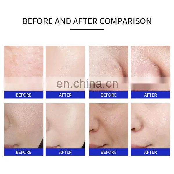 3 In1 Diamond Microdermabrasion Hydra Beauty Machine Facial Peeling Suction Oxygen Jet Skin Rejuvenation Dermabrasion Instrument photo-5