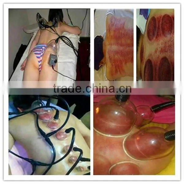 Vacuum Breast Enlargement / Vacuum Butt Lifting Machine photo-3