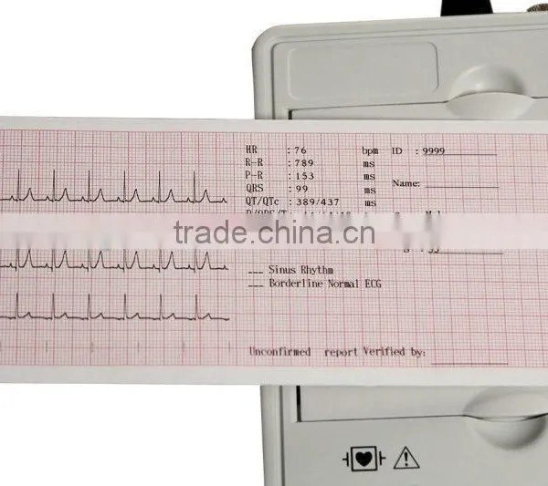 CE Approved Color ECG Machine/ Electrocardiograph/three Channel EKG Machine photo-4