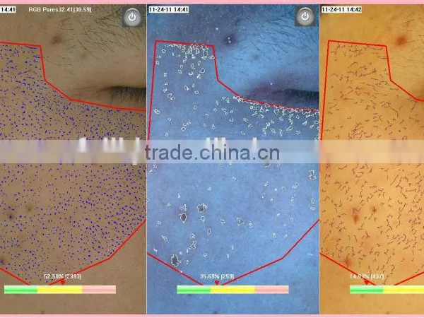 3D Intelligent Skin Analyzer Machine Best Selling Skin Analyzing Equipment photo-5