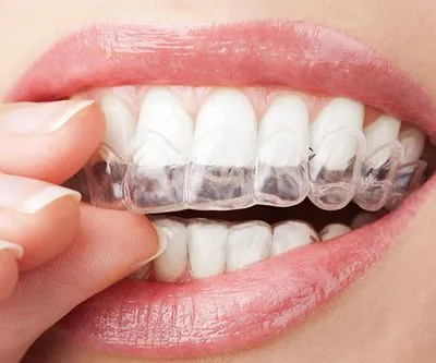 China Outsourcing Dental Lab Dental Laboratory in China Zirconia Crown Outsource To China photo-4