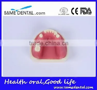 Dental Implant Practice Model With Gingival School Teaching Demonstration Models photo-2