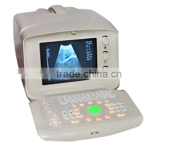 2016 CE Approved Digital Portable Style Ultrasound Machine/Scanner With Cheap Price photo-3