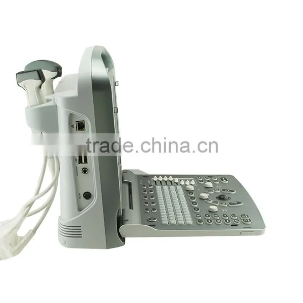 Medical Equipment Portable Color Doppler Ultrasound Scanner System With Cheap Price photo-5
