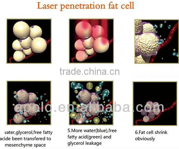 Chinese Apolo CE&ISO Approved Beauty Machine Oem Diode Slimming photo-2