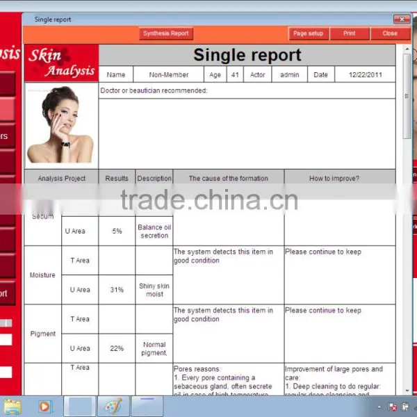 5.0 Mega Pixels Skin Analysis Device With Clear and Accurate Images photo-6
