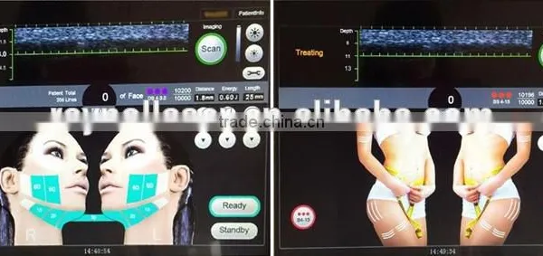 Raynol 2016 EShape-III 5 Transducers HIFU Face and Body Machine photo-6