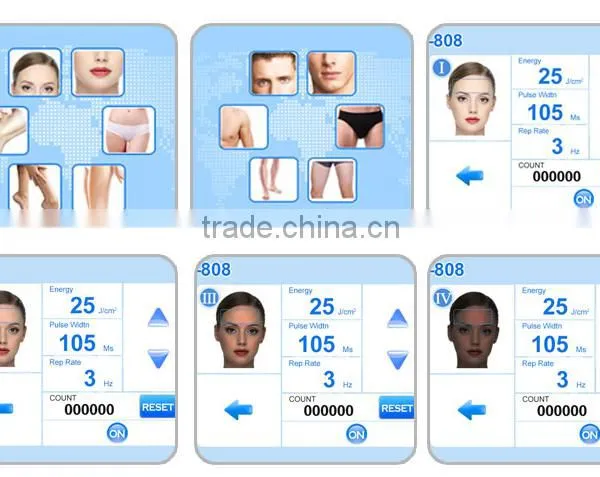 Safe And Effective Portable 808 Diode Laser Treatment For Unwanted Hair Removal From Face By Laser photo-5