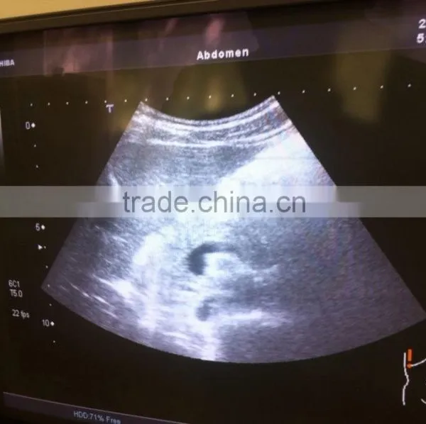 Refurbished Toshiba Ultrasound Scan Probe PVT-375BT Doppler Color Transducer for Xario Aplio photo-4
