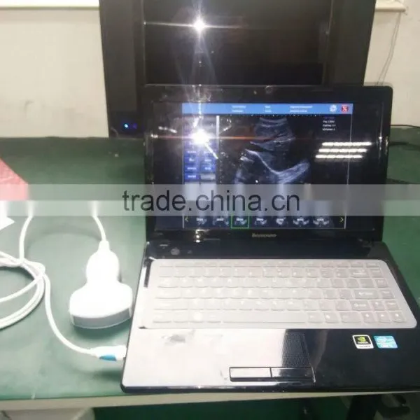 USB Probe B Ultrasound Scanner Integrates Ultrasound Scanner photo-4