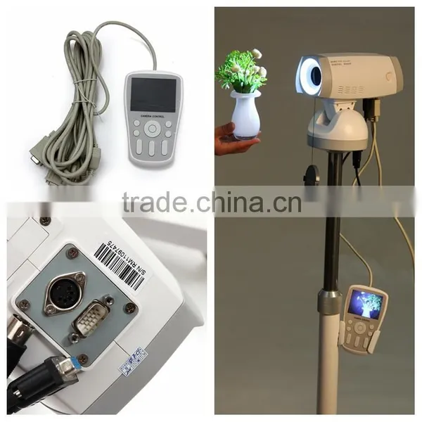 Factory Price Medical Gynaecology Device Portable Digital Video Colposcope for Sale photo-4