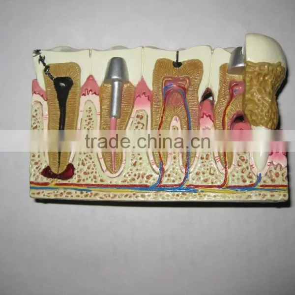 OEM Anatomical Cardiopulmonary Model/anatomical Model/teeth Model/eyes Model/plastic Organ Model photo-4