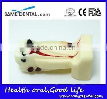 .See Larger Image 4 Times Integrated Pathology Model Dental Eduction Assitant No. DEA-15 photo-3