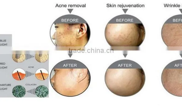 Professional Skin Care Machine photo-5