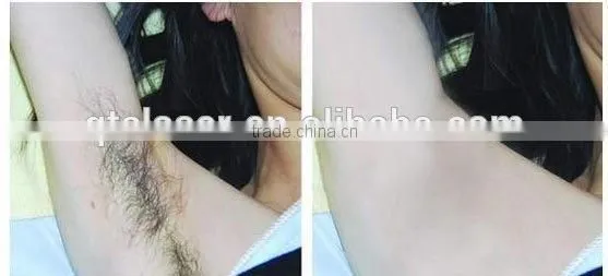 755+1064 Alexandrite Laser Permanent Hair Removal Machine Pigmentation Correctors photo-2