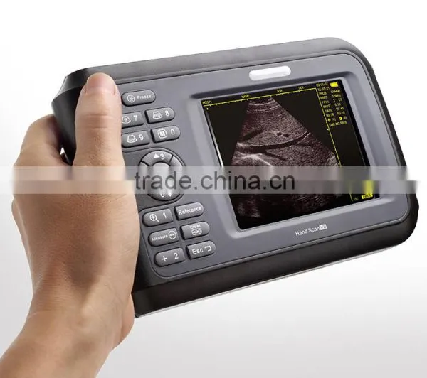V8 Handle Type Digital Veterinary Ultrasound Scanner photo-2