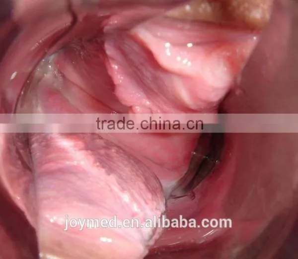 CE Video Colposcope Ultrasound photo-3