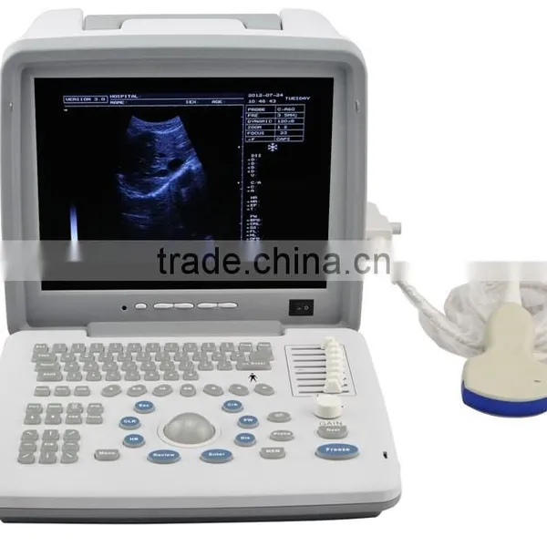 Factory Price Hospital Clinics Equipment Ultrasonic Machine Portable Ultrasound Scanner With Multi Frequency Probe photo-2