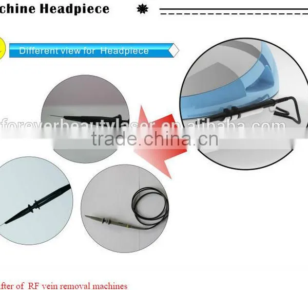 Very Very Nice Spider Removal Machine New Year Pomotion Price -RBS100 photo-2