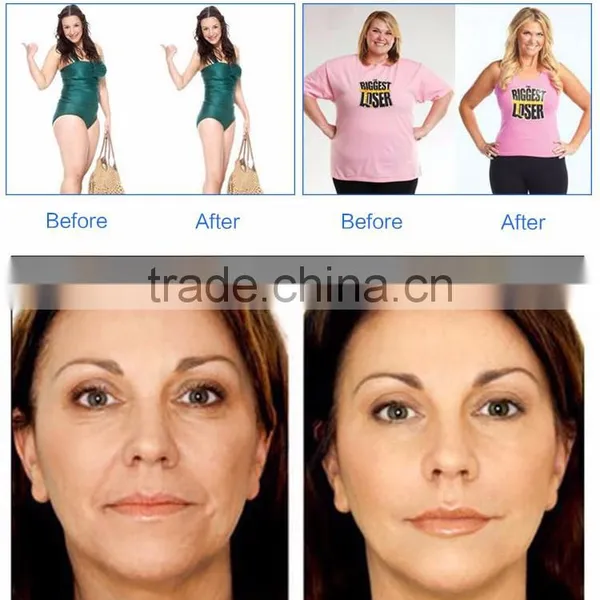 Weight Loss 4 In 1 Body Shaping Multifunctional Multipolar Rf Cavitation Slimming Machine photo-5