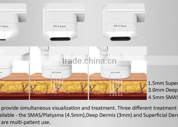 Manufactory China HIFU Hifu Technology Anti Fatty Portable HIFU Treatment Principle With Three Transducer DS4/DS7/DS10 photo-4