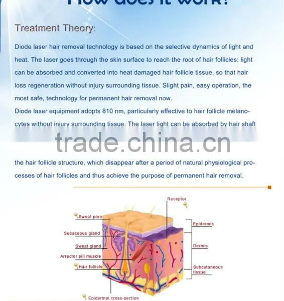 50-60HZ 808nm Diode Laser Unwanted Hair Permanent Hair Removal Machine 3000W photo-2