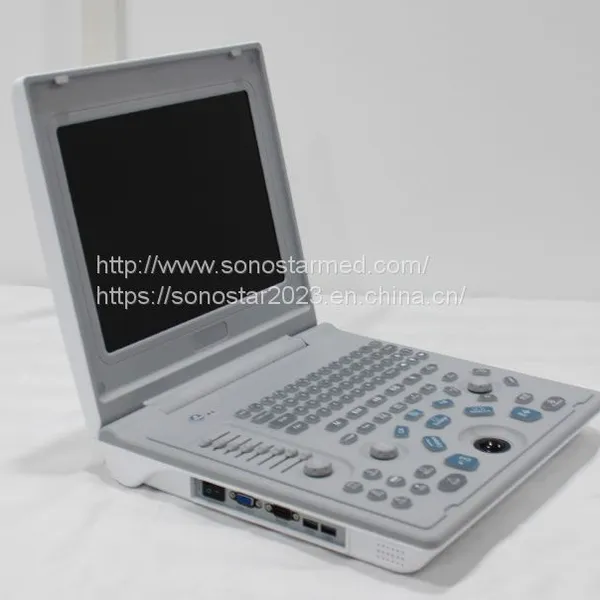 SS-6B Laptop All-Digital Ultrasound photo-2