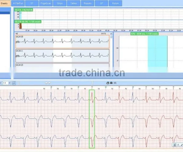 CE Approved 12 Channel Mini 24/48-hour LCD ECG Holter Recorder System With Premier Holter Software-ECGLAB photo-2