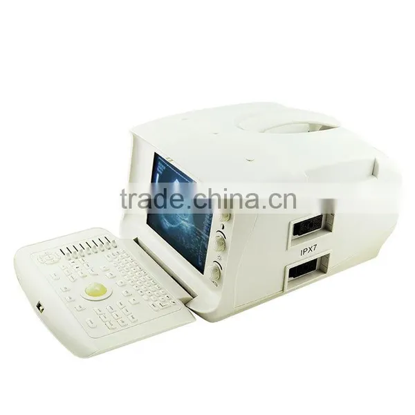 CE ISO Approved One-stop Shopping Service pc Based Ultrasound Scanner Portable Laptop photo-4
