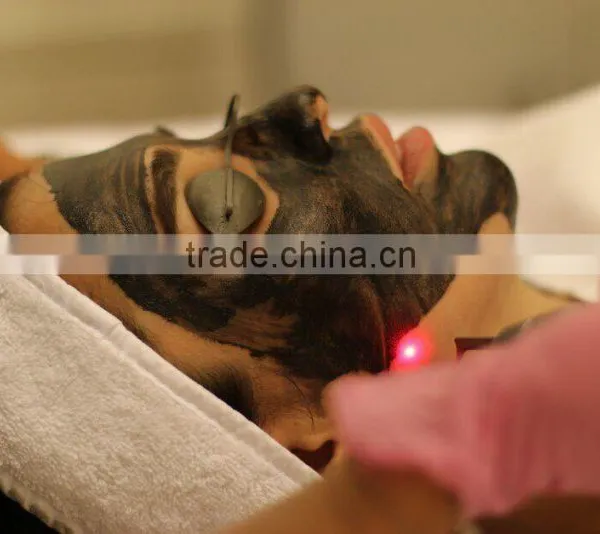 Q Switch Laser Tattoo Removal Q Switched Nd Yag Laser 532nm 1064nm Tattoo Removal And Black Spot Removal Machine Naevus Of Ito Removal photo-6