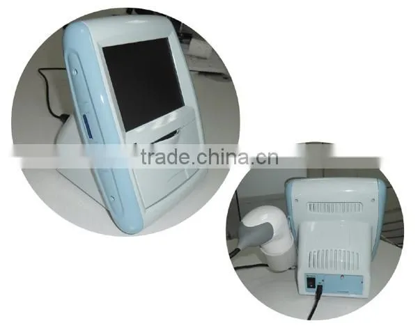 CareScan-1 Bladder Scanner Diagonosis Portable Scanner photo-4